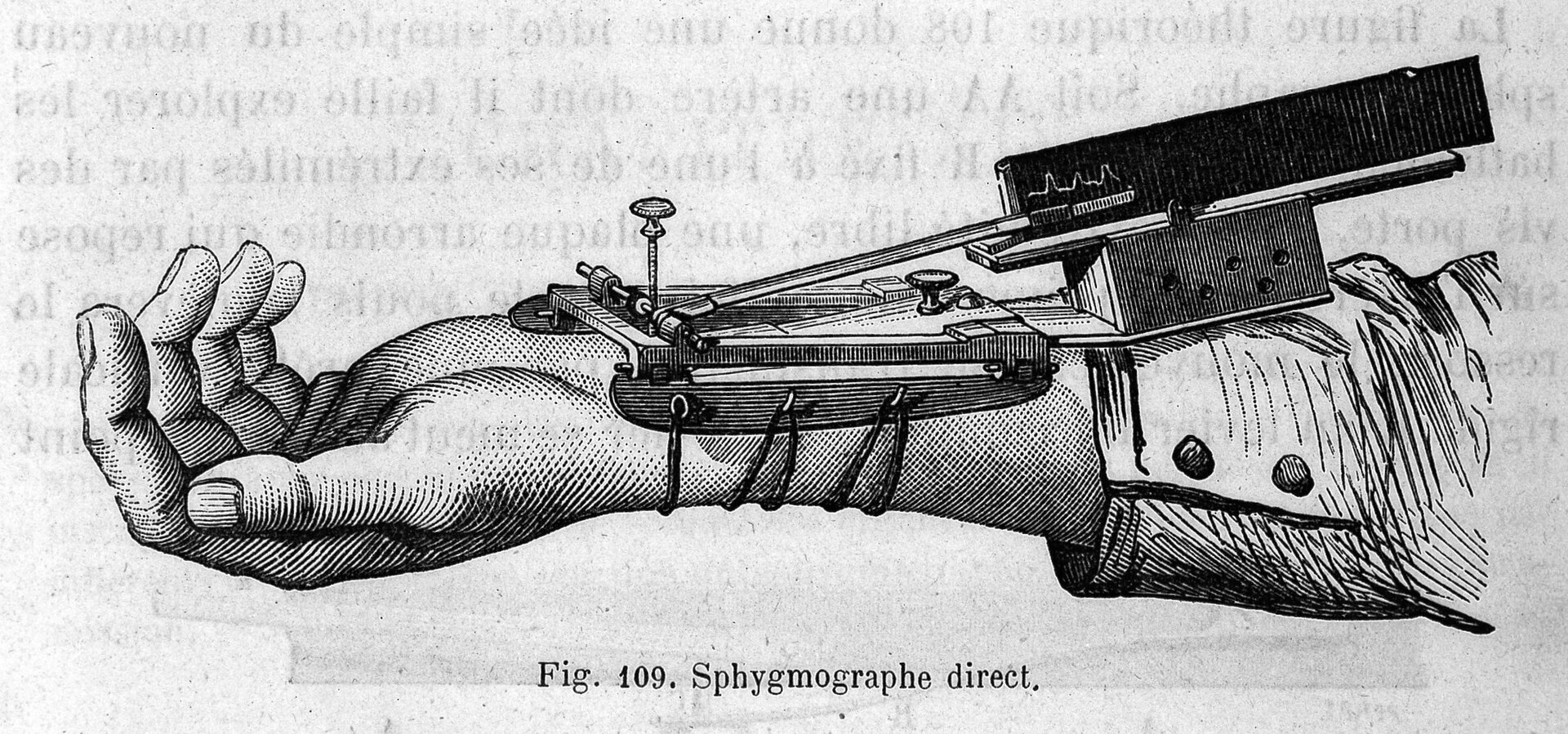 Engraving from a physiology book: a direct sphygmograph strapped to a wrist, its lever tracing the pulse on a small plate.